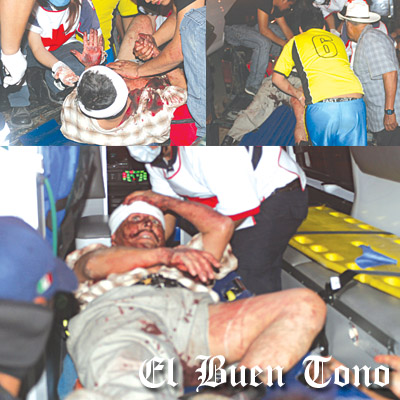 golpeado en asalto