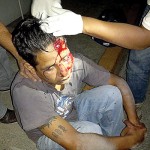 golpean jovenes