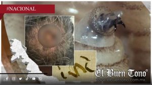 Detectan en Veracruz los primeros casos humanos de gusano barrenador