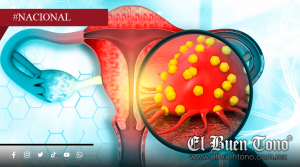 Muerεn 13 mujeres al día por cáncer cervicouterino en México