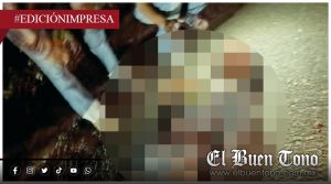 Pierde un ple; MOTOCICLISTA SUFRE GRAVE ACCIDENTE