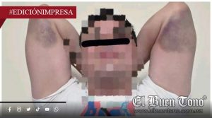 Frenazo lesiona a pasajero; empresa niega apoyo médico
