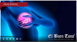 Cáncer de mama deja más de 8 mil muertes al año en México; reportan 23 fallecimientos diarios